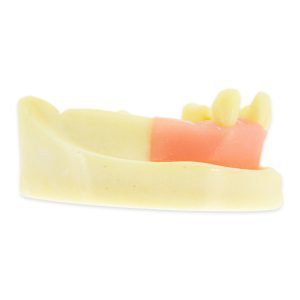 MODELO DE ESTUDIO EXODONCIA INFERIOR M2028-4 MACHTIG - Imagen 2