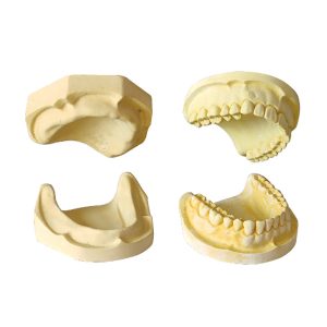 MODELO DE YESO PARA ESTUDIO PAR