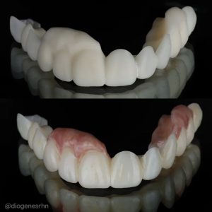 RESINA PARA IMPRESORA 3D BIO PROV PARA CORONAS TEMPORALES - PRIZMA 3D - Imagen 2