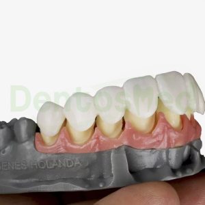 RESINA PARA IMPRESORA 3D BIO PROV PARA CORONAS TEMPORALES - PRIZMA 3D - Imagen 3